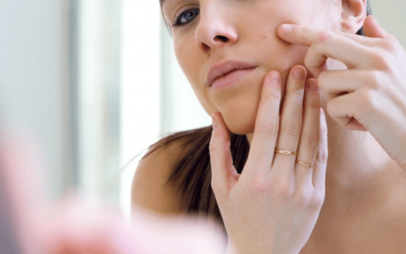 mujer extirpando granos rostro acne espinillas cursos de estetica en parla-academia-peluqueria-estetica.com